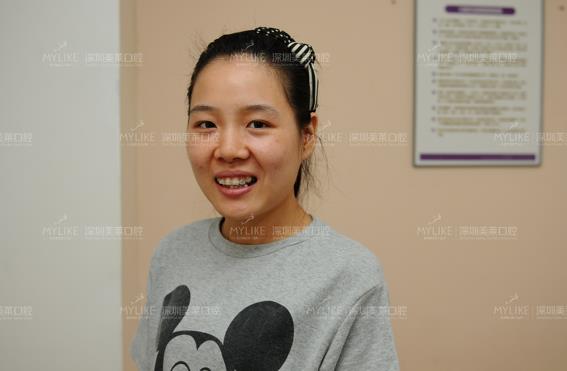 冰晶半隐形矫正